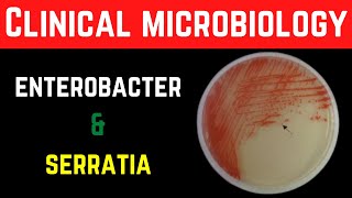 Enterobacter Cloacae amp Serratia Marcescens ClinicalPathogenesisInvestigationsTreatment Prevention [upl. by Sommers150]