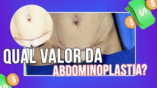 QUAL VALOR DA ABDOMINOPLASTIA CIRURGIA PLÁSTICA [upl. by Anailuy]