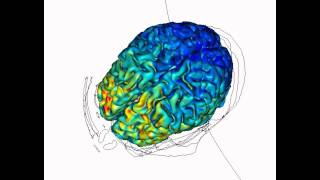 Cortical Modulation using tDCS  HighResolution Computational Model of tDCS [upl. by Iret432]