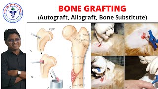 BONE GRAFTING  Lecture 05  Orthopedics [upl. by Thessa408]