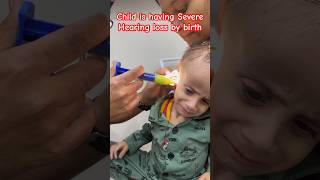 Ear impression viral hearingaids shortsfeed bhilai chhattisgarh viralvideo delhi mumbai [upl. by Gnanmos]