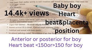 My baby reports placenta position and heart beat of gender based on placenta positionbaby reports [upl. by Asilanom]