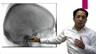 eQ Recent Exam Questions Radiology  Myelography by Dr Sumer Sethi [upl. by Moyer]