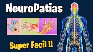 Neuropatias  Sintomas diagnostico y tratamiento  Neuropatia periferica [upl. by Yslehc]