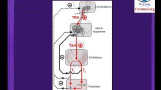 Hypothyroidie comment reconnaitre goitre debutant Glande thyroïdienne nodulaire symptomes nodule [upl. by Bunch]