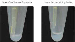 Avoid These Two Problems With Sepharose for Immunoprecipitation [upl. by Aynek]