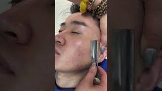 shaving beard dandruff 7 [upl. by Airamahs498]