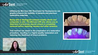 Microlux DW Illuminator Makes dental evaluations more effective [upl. by Arne]