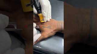 Remoção de tatuagem remocaodetatuagem micropigmentacao tattoo [upl. by Avilla568]