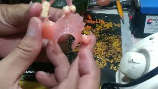 Flexible na Pustiso Valplast Ultra Thin Flexible dentures Philippines DatuAmbasTv [upl. by Pincince]