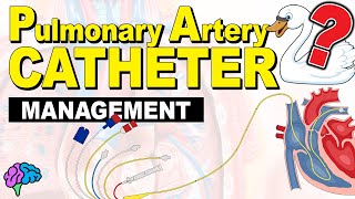 PA Catheter Management [upl. by Prissie]