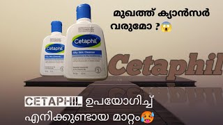 എൻറെ പൊന്നേ🥵💥Cetaphil ഉപയോഗിച്ച് ഇങ്ങനെയൊക്കെ Cetaphil face wash dermatologist recommend product🎯 [upl. by Genia187]