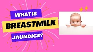 Breastmilk jaundice Breastfeeding jaundice Dr Sridhar K bilirubin neonataljaundice breastmilk [upl. by Elgar]