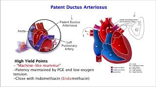 Patent Ductus Arteriosus [upl. by Bobbette891]