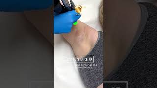 Laser Hair Removal Cynosure Elite IQ [upl. by Tacye502]