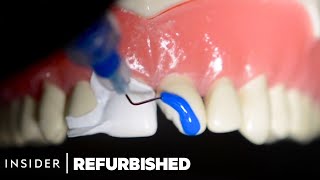 How Damaged Teeth Are Professionally Restored  Refurbished  Insider [upl. by Brainard]