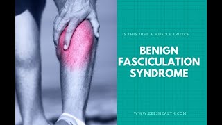 Benign Fasciculation Syndrome Symptoms and Causes  Diagnosis  Treatment  Prevention [upl. by Eitsyrc]