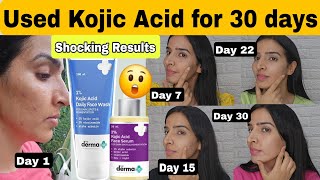 Used Derma co Kojic acid face wash and serum for 30 days 😳 Shocking Results 😨 [upl. by Ireg]