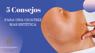 Cómo Mejorar tus Cicatrices 5 Consejos Efectivos para una Cicatrización Estética [upl. by Kyte]