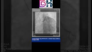 Coronary Angiography CAG Procedure  Deepak Heart institute [upl. by Anirtik308]