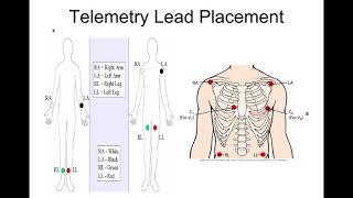 Basic ECGs For Nursing and Paramedic Students [upl. by Mendy]