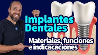 ImplantesDentales materiales funciones e indicacaciones [upl. by Waine847]