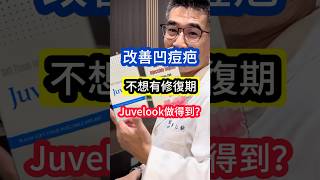 改善 凹痘疤 不想有 修復期 Juvelook 做得到⁉️ 吳仁欽皮膚科診所 喬雅露 頸紋 痘疤 膠原蛋白增生 舒顏萃 玻尿酸 淚溝 細紋 毛孔粗大 皮下剝離術 [upl. by Fessuoy994]