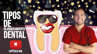 TIPOS de BLANQUEAMIENTO DENTAL 👄 ESTOS SI FUNCIONAN✔️✔️✔️ 36 [upl. by Heall]