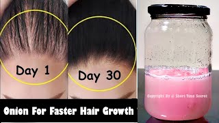 How To Use Onion Juice For Extreme Hair Growth  15 Days Challenge for Longer and Thicker Hair [upl. by Corb]