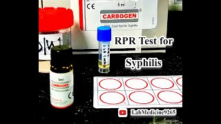 Rapid Plasma Reagin RPR Test  Serology  tulipdiagnosticspvtltdgoa [upl. by Darej]