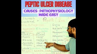 Peptic Ulcer Disease Unveiled How Ulcers Form amp Progress  Pathogenesis Explained [upl. by Nelan369]