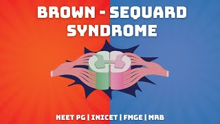 BrownSequard Syndrome  Explained in Tamil  NEET PG  INICET  FMGE  MRB [upl. by Asabi]