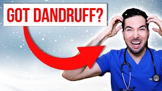 How to get rid of dandruff permanently at home and treatment [upl. by Aisha38]