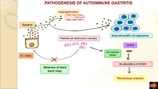 Autoimmune gastritis  DrVshanthi [upl. by Neeham165]