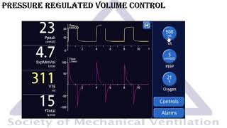 Modes of mechanical ventilation Pressure Regulated Volume Control PRVC [upl. by Ermengarde286]