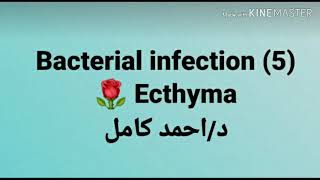 5 Ecthyma 👉 Bacterial infection by Dr Ahmed Kamel [upl. by Anelim554]