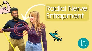 The Ultimate Guide to Radial Nerve Entrapment [upl. by Ahsilrak390]