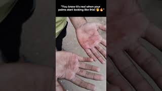 quotThese blisters tell a story of grind and gains 💯 quotcalisthenics memes strength viralvideo [upl. by Bronson]