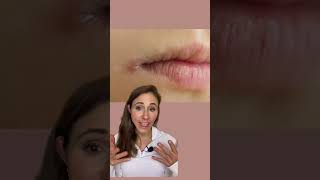 How To Get Rid Of Angular Cheilitis For Good dermatologist [upl. by Marcille]