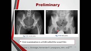 Anatomi Radiologi Urethrocystography  Cystourethrography radiology radiologiunisa urinary [upl. by Schuman85]