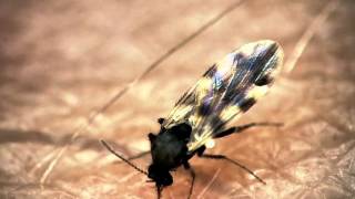 Midge bites through presenters arm  The Secret Life of Midges  BBC One [upl. by Rutherford]