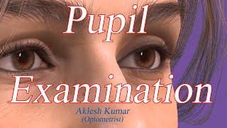 Pupil Examination  RAPD  Pupillary Light Reflex  Marcus Gunn Pupil  Swinging flashlight Test [upl. by Baum]