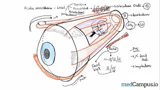 Peribulbar block vs retrobulbar block  Ocular anesthesia  Ophthalmology medcampus [upl. by Adim]