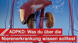 ADPKD  Wissen über Zystennieren Symptome Diagnose Therapie und Alltag [upl. by Ydoc]