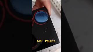 CRP test procedure  CRP blood test  medicalstudent youtube shorts [upl. by Ecital]