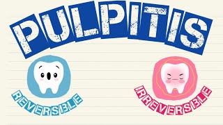 pulpitis What Is Reversible and Irreversible PULPITIS [upl. by Tierell157]