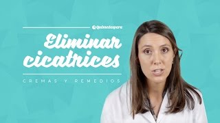 Eliminar cicatrices Cremas y remedios [upl. by Inail]