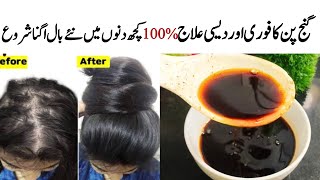 Hair Fall Solution At Home  Onion Hair Oil Remedy For Hair Growth  100 Result [upl. by Kaspar357]