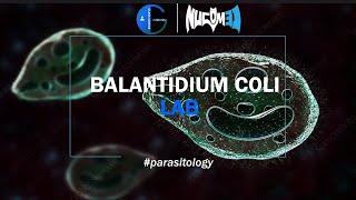 Balantidium coli  DrHuda  LAB 13 [upl. by Curzon679]