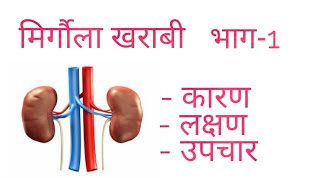 Kidney disease in NepaliDr Bhupendra Shah [upl. by Ayek]